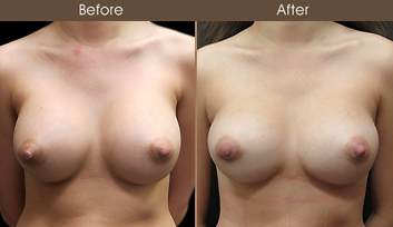 20202608201251_B188-Front-Template